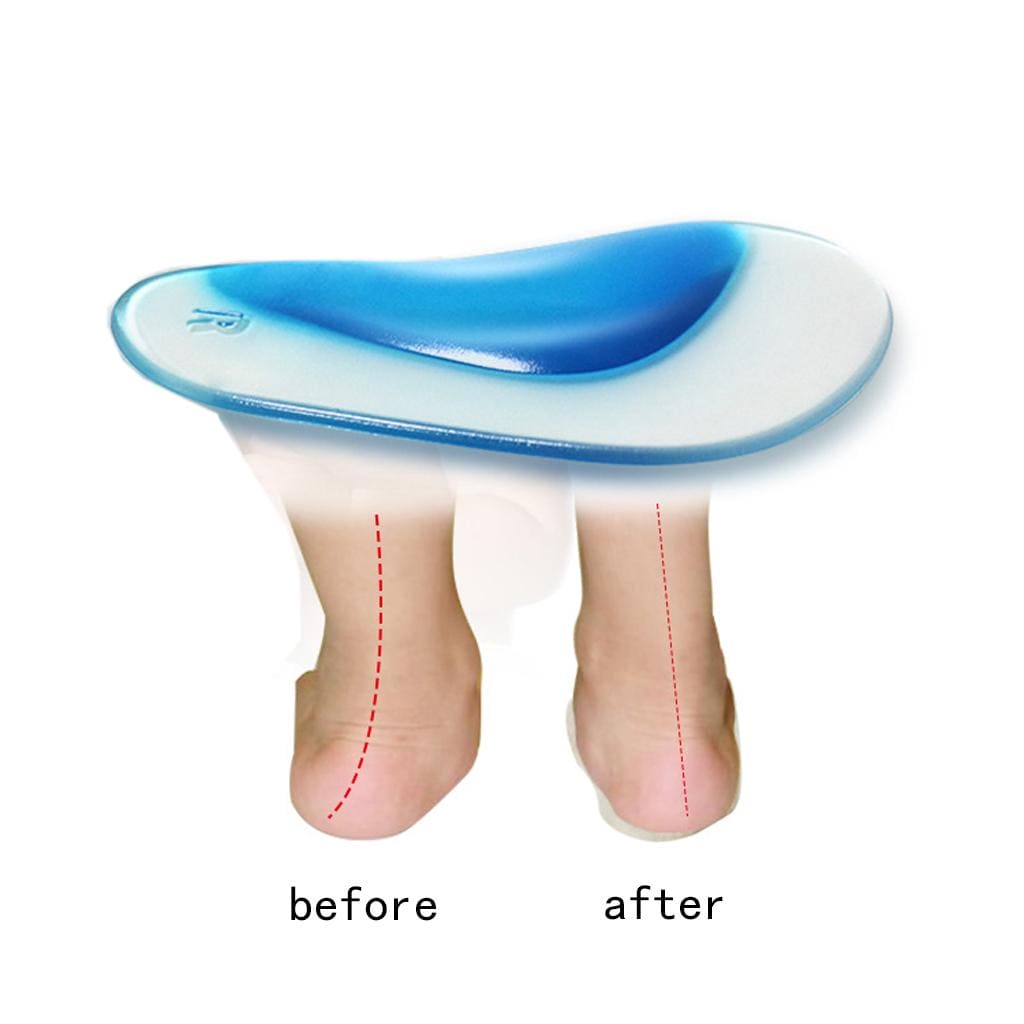 Pair Of High Arch Support Insole, Silicon Flat Foot Corrector, Cushion Insert Gel Orthopedic Pad, Orthopedic Arch Support Insole, Wedge Shoe Insert for Women Men, Reusable Arch Inserts for Plantar Fasciitis