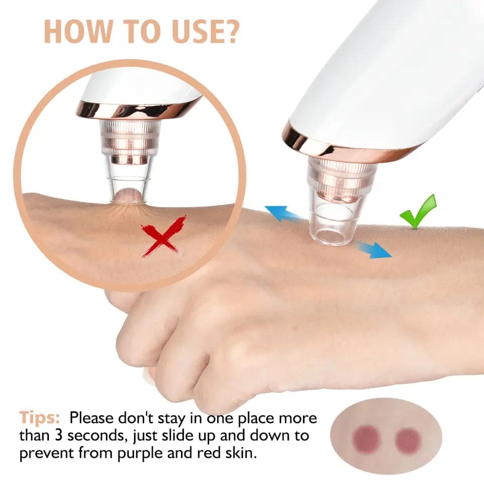 Electric Blackhead Remover, Vacuum Acne Cleaner, Black Spots Removal Device, Pore Cleaner Machine, Skin Care Tools, 5 Heads Suction Machine, Vacuum Electric Black Head Extractions Tool, Electric Facial Pore Cleaner, Exfoliating Beauty Device
