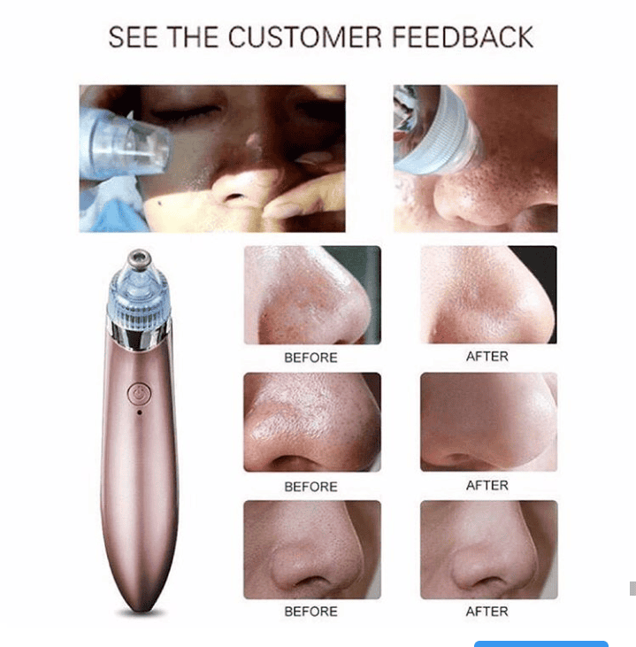 Blackheads Remover Vacuum Suction, Blackhead Removal Machine, Deeply Facial Cleaning Tool