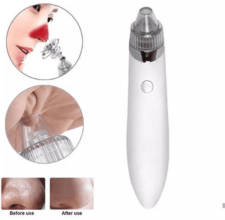 Blackheads Remover Vacuum Suction, Blackhead Removal Machine, Deeply Facial Cleaning Tool