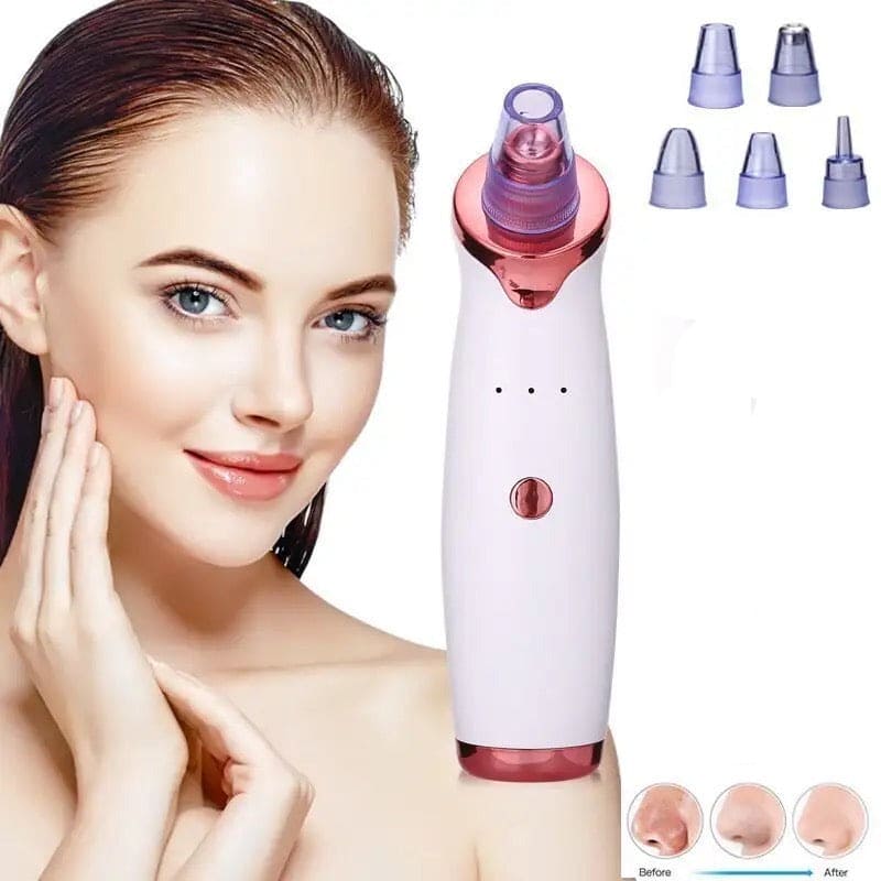 Bubble Black Head Remover, Vacuum Pore Cleaner, Acne Cleanser, Black Spots Removal, Face Nose Deep Cleaning Tools, Pimple Pore Cleansing Device, Beauty Skin Care Tool, 5 Sensors USB Rechargeable Blackhead Vacuum Cleaner Kit for Women and Men