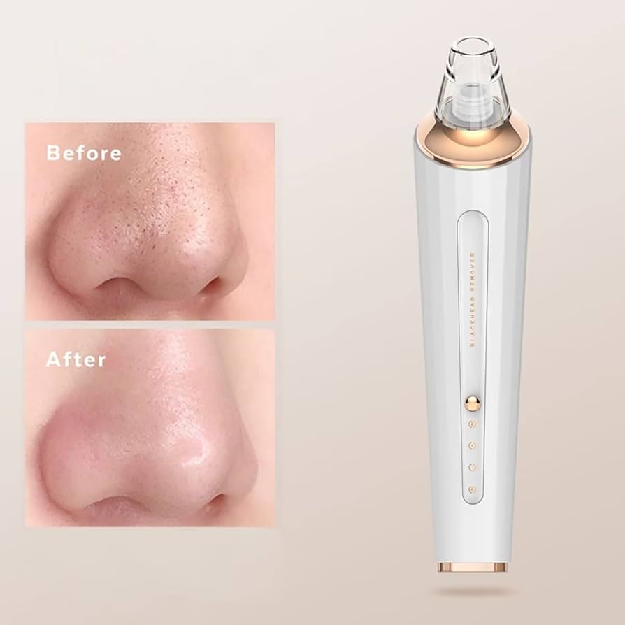 Rechargeable Facial Pore Cleaner, Blackhead Remover Pore Vacuum, Blackhead Suction Device Kit