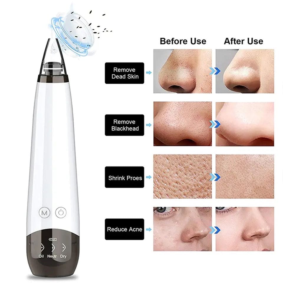 Black Spot Suction Vacuum, Blackhead Remover Cleaning Device, Electric Facial Pore Cleaner, Skincare Exfoliating Beauty Device, Facial Pore Acne Pimple Cleaner, Facial Tag Vacuum Suction, Household Professional Facial Pore Pimple Cleanser