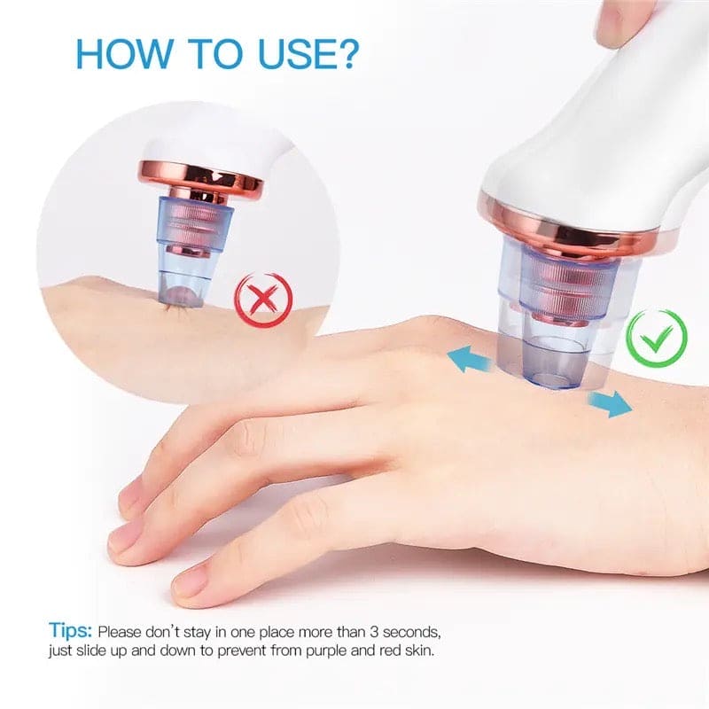 Bubble Black Head Remover, Vacuum Pore Cleaner, Acne Cleanser, Black Spots Removal, Face Nose Deep Cleaning Tools, Pimple Pore Cleansing Device, Beauty Skin Care Tool, 5 Sensors USB Rechargeable Blackhead Vacuum Cleaner Kit for Women and Men