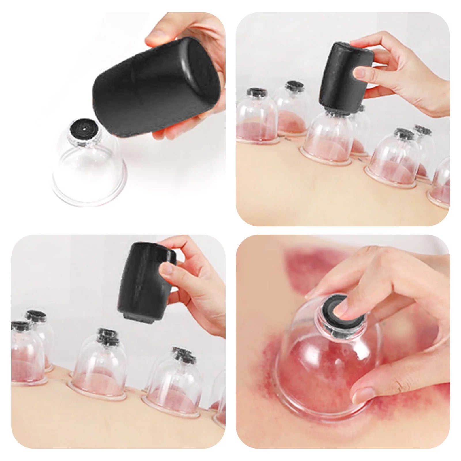 Smart Cupping Device, Vacuum Suction Cupping Massager With 6 Cups, Electric Cupping Massager, Electric Universal Cupping Kit, Body Dredging Electric Hajama Massager