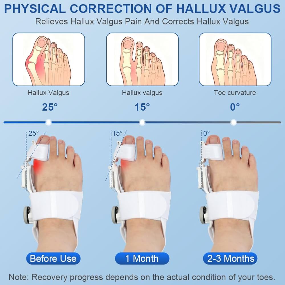 Adjustable Big Toe Straightener Support, Universal Adjustable Big Toe Corrector, Professional Bunion Correction Foot Brace