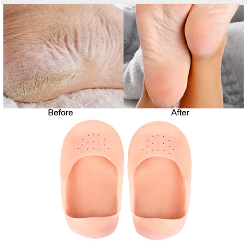Full Silicon Gel Socks, Anti Crack Heel Socks, Moisturizing Socks For Foot Care And Heel, Full Length Silicone Foot Protector, Cracked Heel Treatment Socks, Men And Women Gel Heel Protectors
