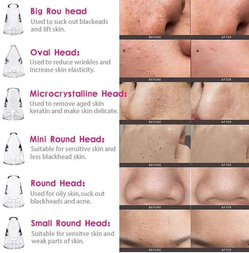 Electric Vacuum Pore Cleaner,  6 In 1 Blackheads Removing Device, Facial Black Spots White Dot Pimple Acne Cleaner, Beauty Extractor Skin Care Tools, Black Point Vacuum Suction Device, USB Rechargeable Bubble Beauty Instrument