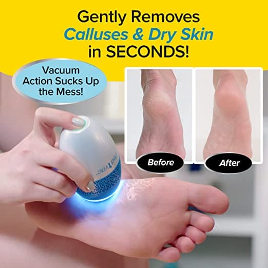 Pedi Vac Callus Remover, Callus Remover For Feet, Dead Skin Remover, Electric Callus Shaving Remover, Electric Foot File Callus Remover