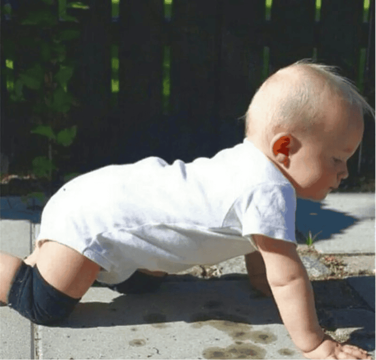 Baby Crawling Anti-Slip Knee Protector, Leg Warmers Kids Knee pads, Adjustable Kneepads for Toddlers